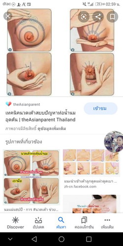 เต้านมอักเสบ