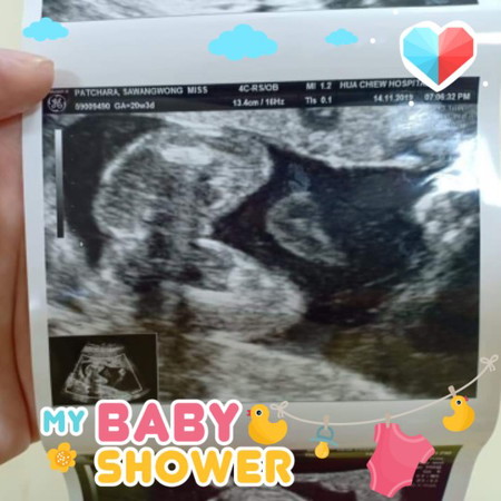 ขอดูภาพอัลตร้าซาวน์ลูกสาวหน่อยค่ะแม่ๆ
