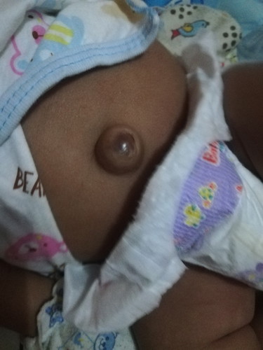 สะดือน่ากลัว