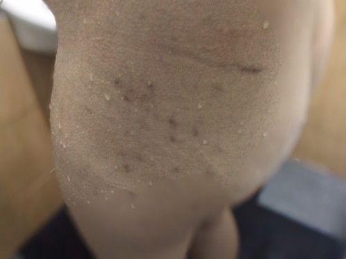 ใครประสบปัญหารอยแตกแบบนี้กันบ้างคะ