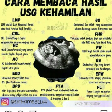 USG
