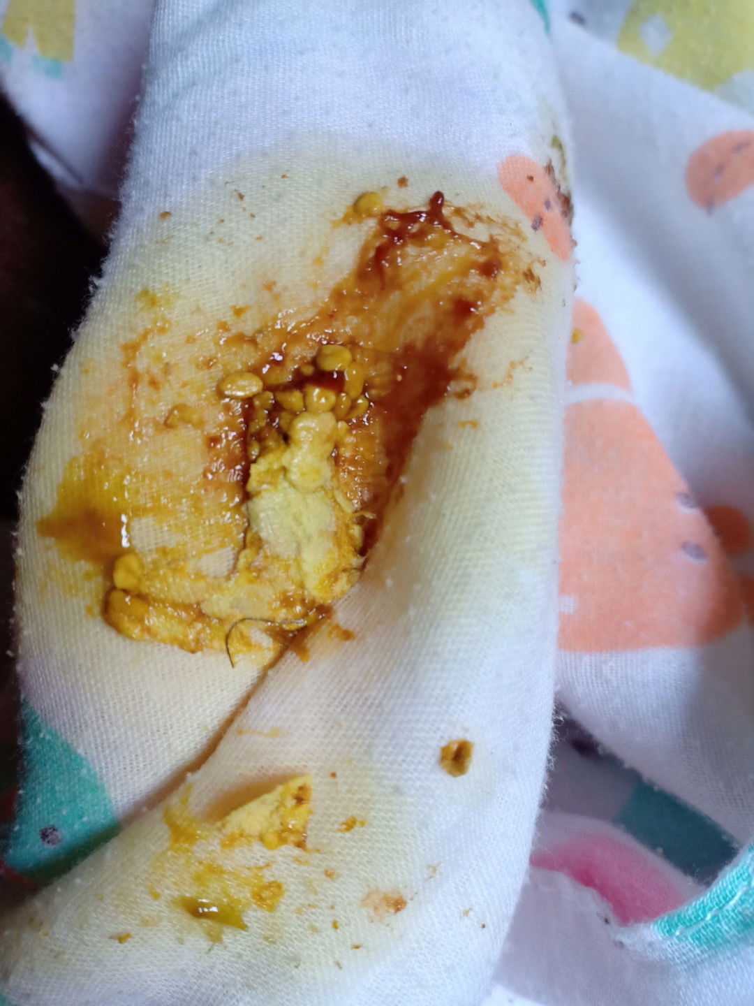 ลูก 5เดือนถ่ายมีเลือด