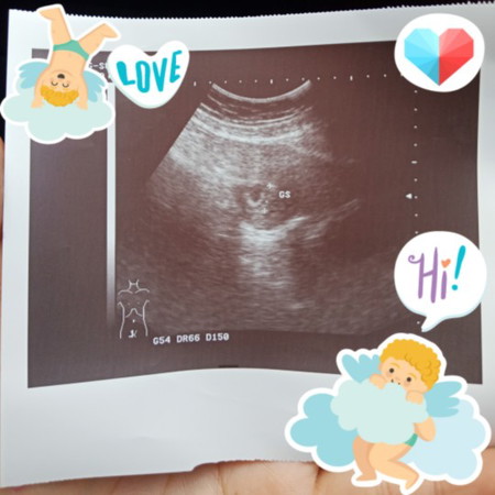 7 สัปดาห์ 6 วัน ?