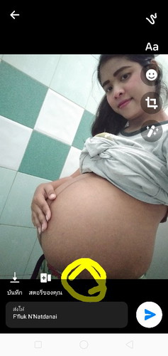 เจ็บและตึง