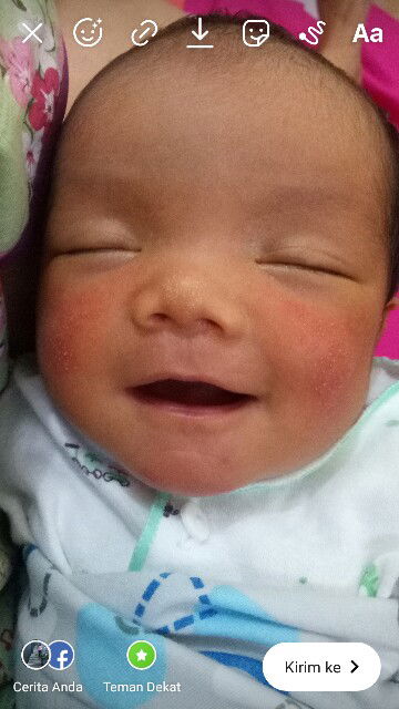 merah merah di kulit