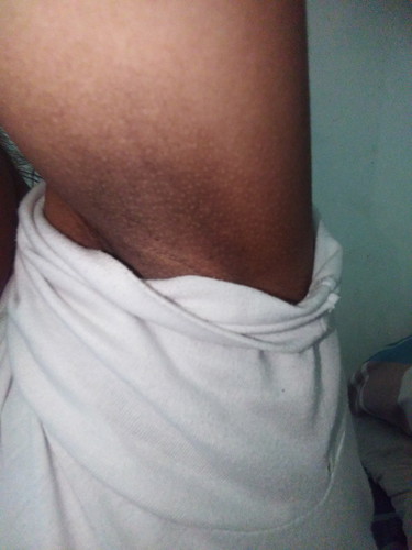 Preg