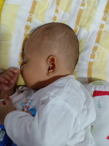 น้องได้3เดือน15วันเริ่มหัวแบนทำไงดีคะ ให้นอนตะแคงตอนกลางวันแต่ช่วงกลางคืนไม่ยอมนอนมีวิธีไหนบบ้างคะ