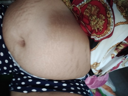 ฉันกำลังตั้งตรรภ์