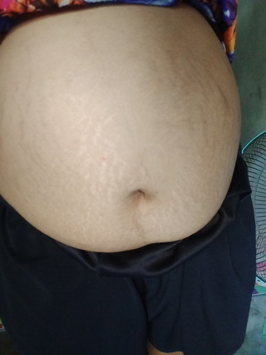 ฉันกำลังตั้งครรภ์