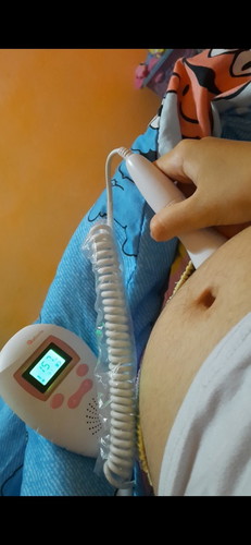เครื่องฟังเสียงหัวใจเด็ก