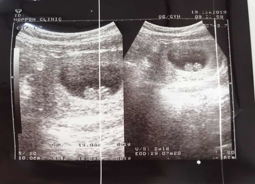8 week 1 day ??