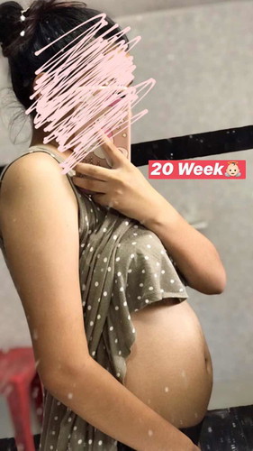 ท้องออกยังค่ะเเม่ๆเเบบนี้ 20+4 วีค