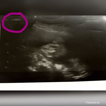 Baby Girl?