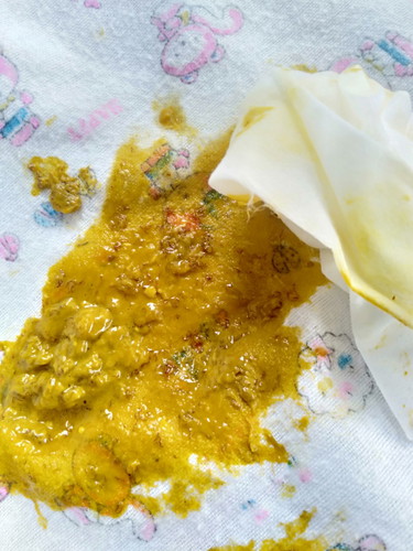 น้องถ่ายออกมามันเป็นพยาธิมั้ยอ่ะค่ะ