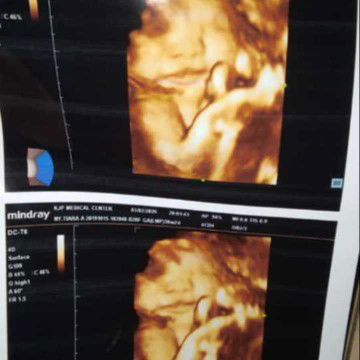 worry liat hasil foto si dede...