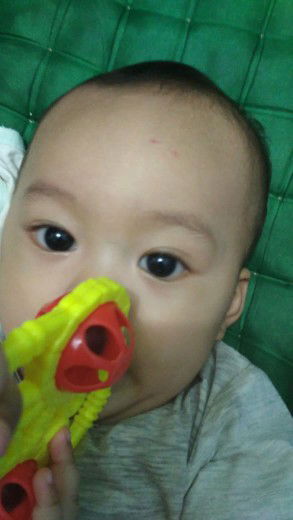 bintik merah d kening seperti d gigit sesuatu