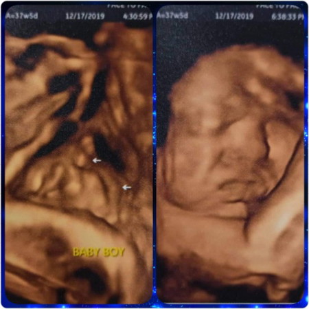 It's A Boy! 38 Weeks And 2 Days