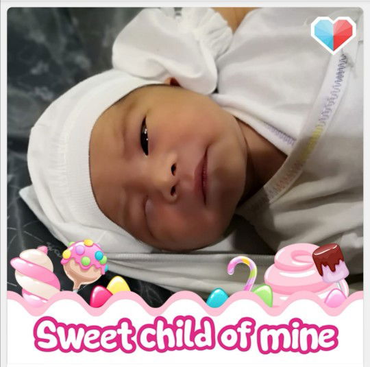 Stretch marks Concern And Other Things