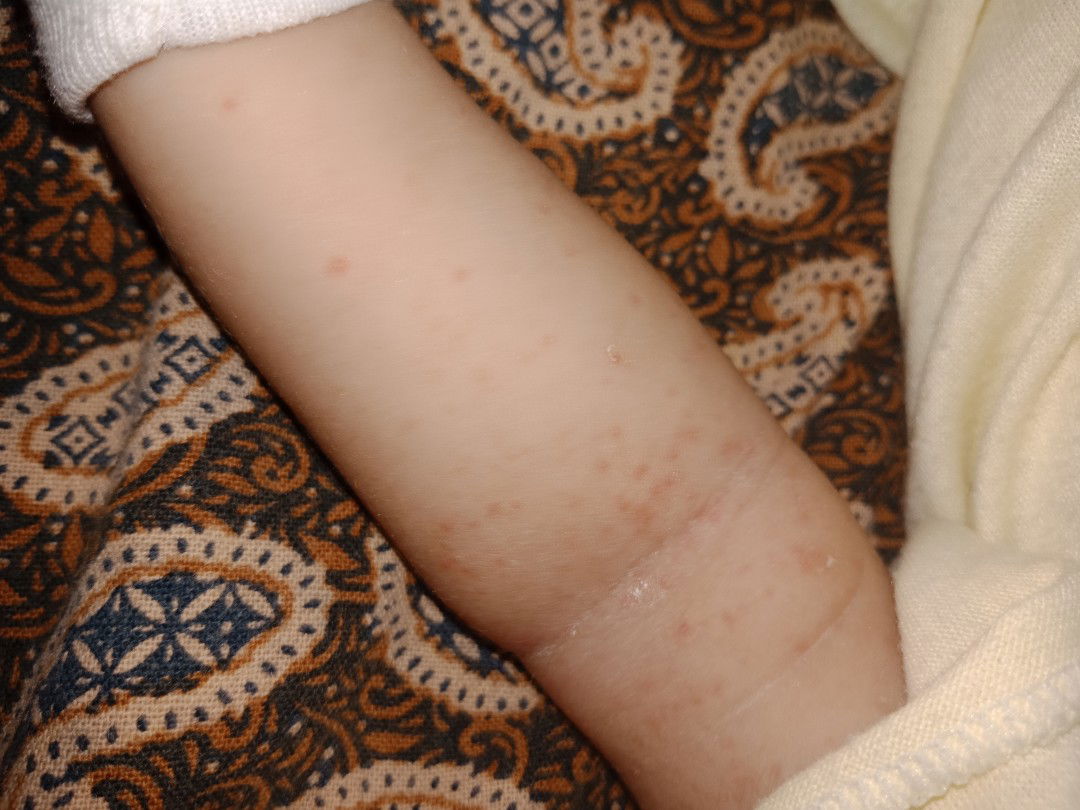 Biang keringat atau bukan??