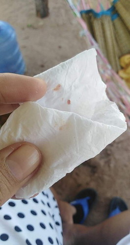 มีอายุครรภ์ 36+1 วีค