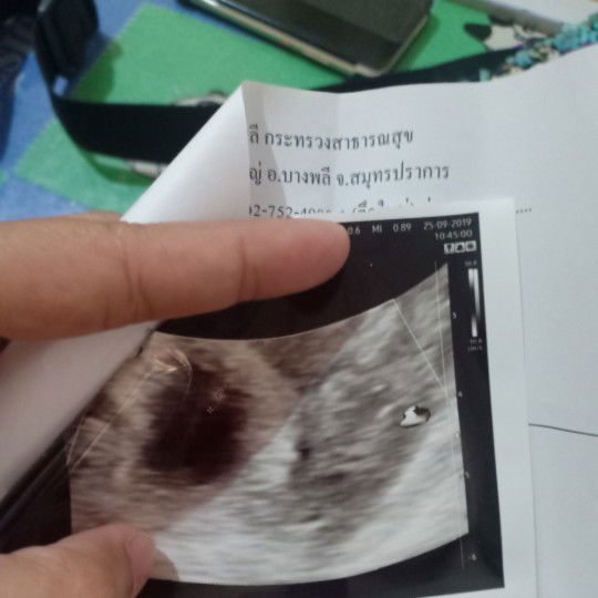 วันที่ได้คำตอบเป็นวันที่หัวใจสลาย