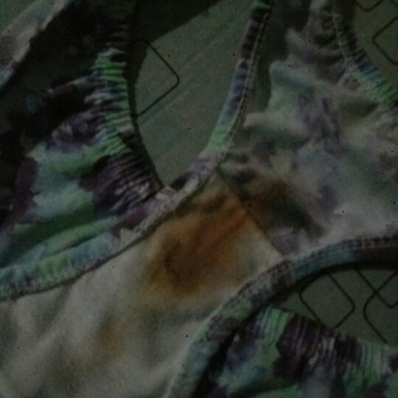 Brown discharge
