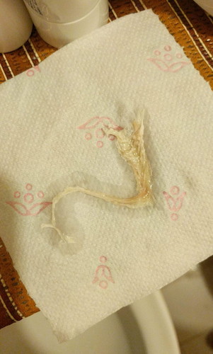 Implantation bleeding po kaya ito?