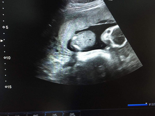 four months