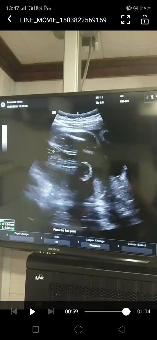 แม่ๆช่วยดูเพศน้องหน่อยค่ะ