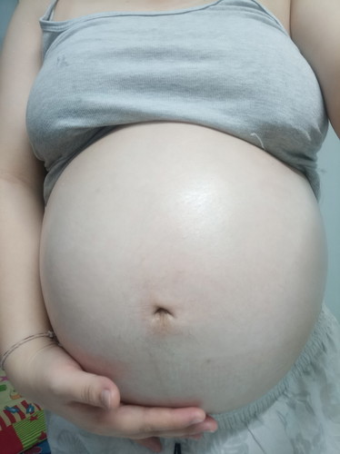 31w+6