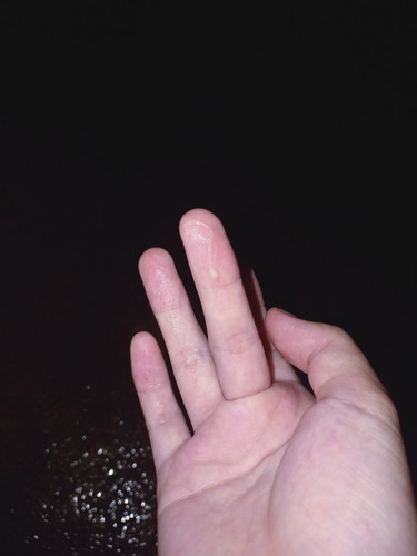 คืออะไรเหรอค่ะ