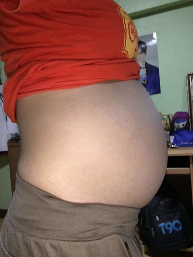 ท้องเล็กหรือปกติ