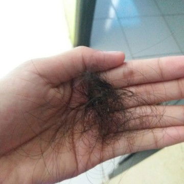 rambut rontok