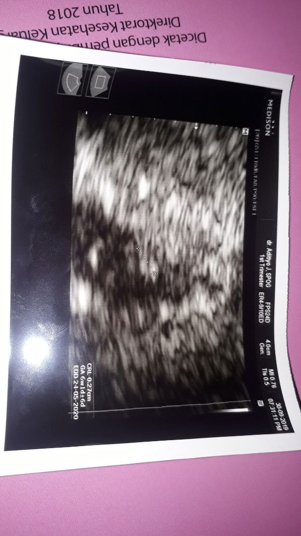 berkembang atau tidak?