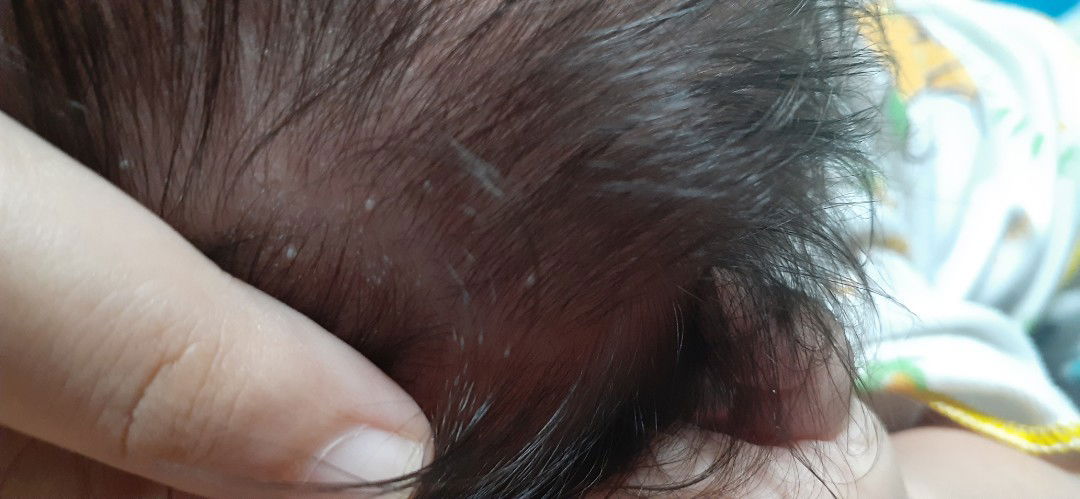 Bintik putih dikepala