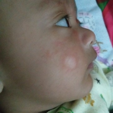 pipi merah