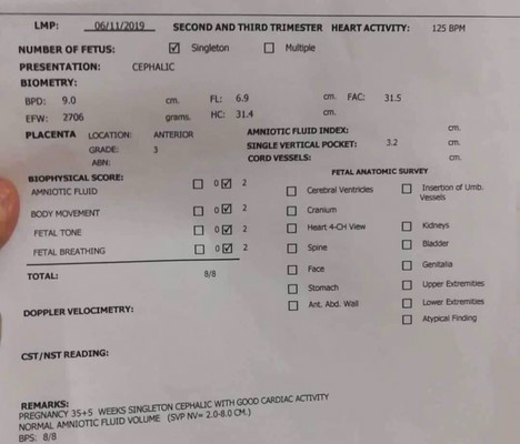 Gusto na po manganak.