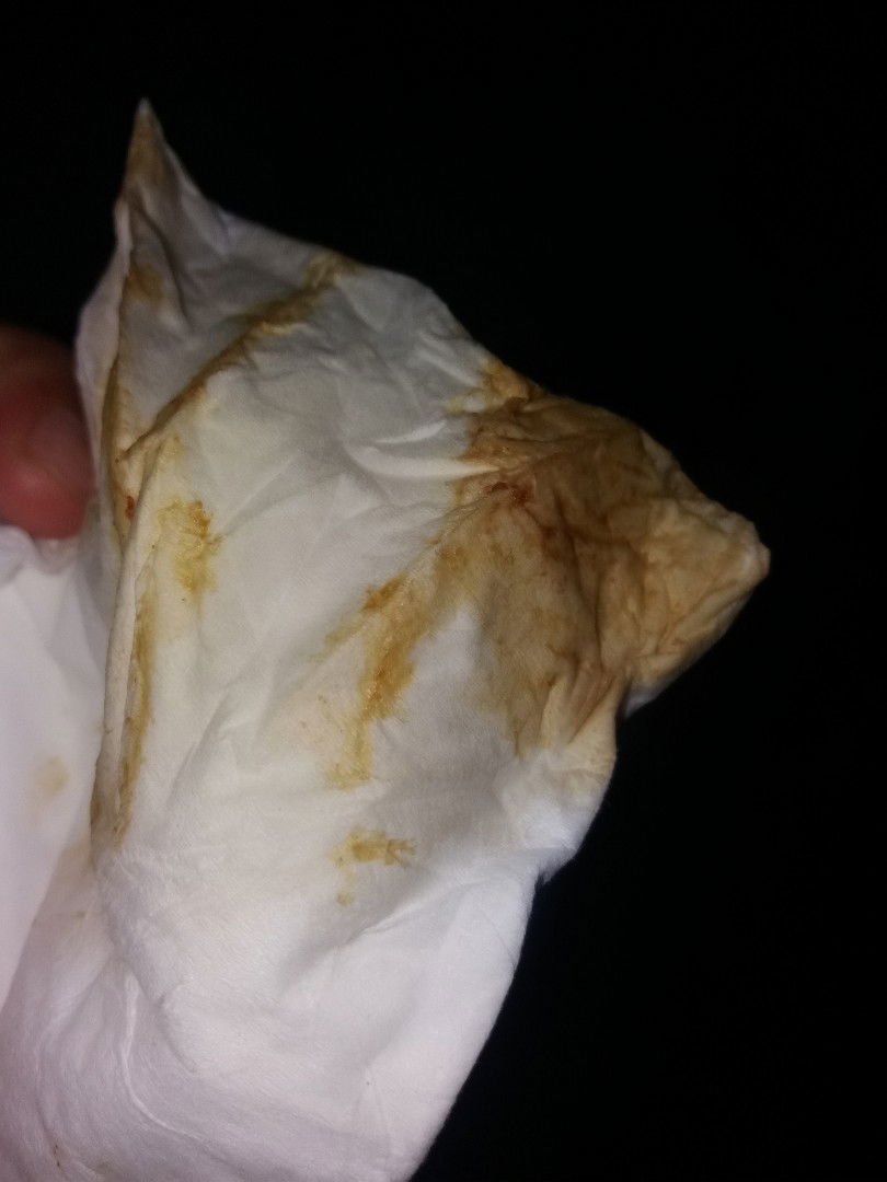 24 weeks keluar cairan ini