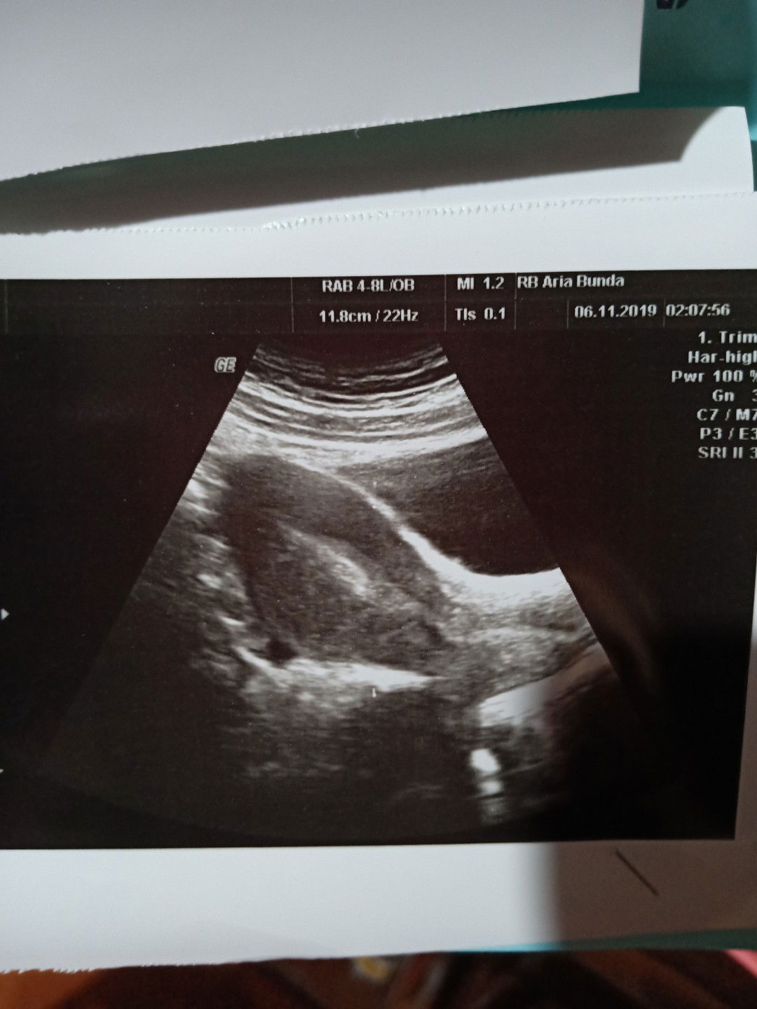 kehilangan sebelum memiliki