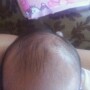 falling hair