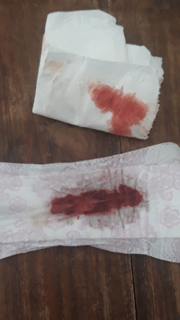 Is bleeding a sign of labor or false labor?