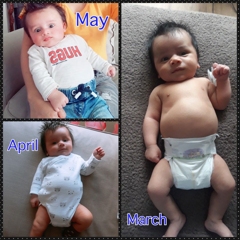 normal lang po ba pag ganito ang tiyan ni baby.