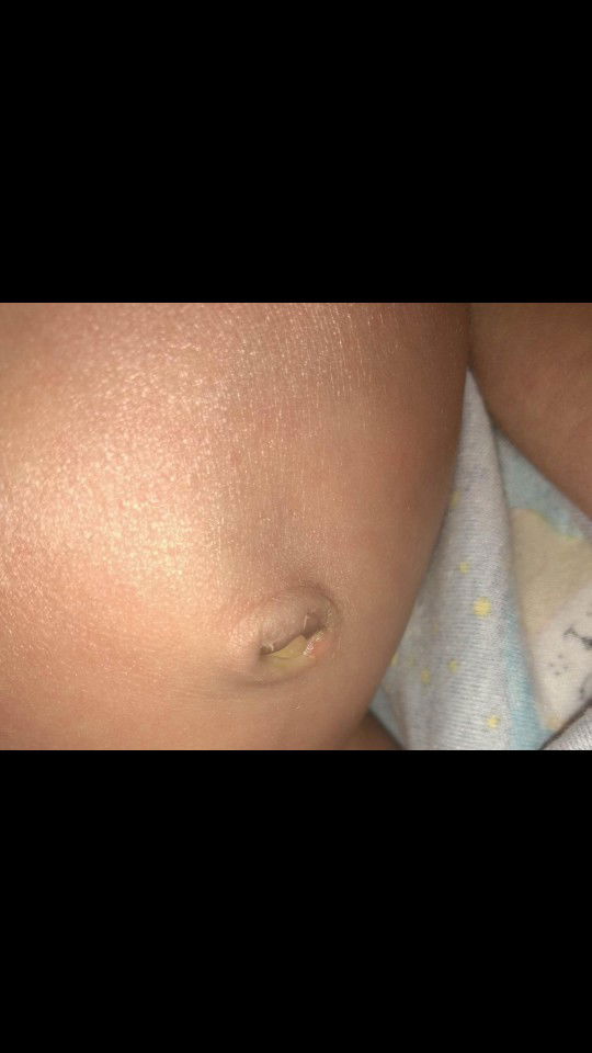 pusar tak kunjung kering