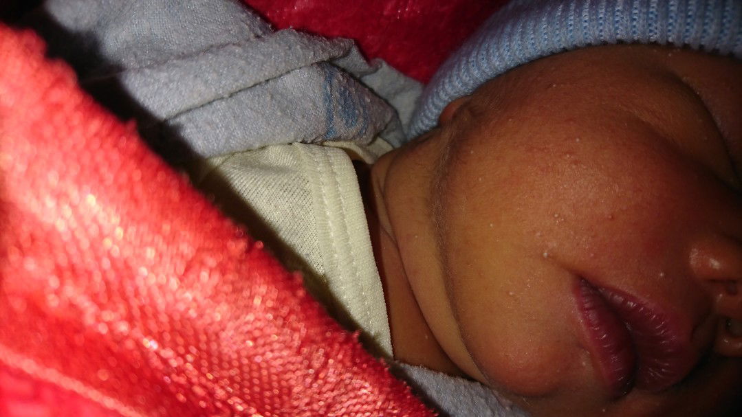 bintik putih di wajah bayi