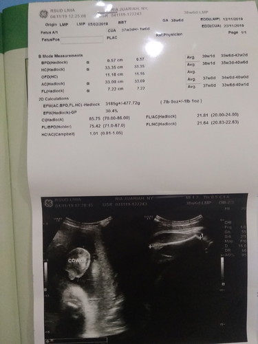 tinggal menunggu waktu