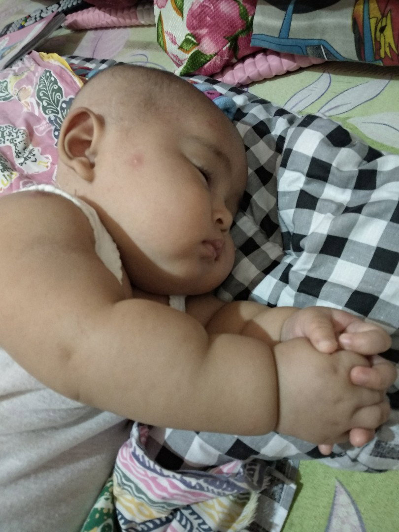 mengembalikan volume asi setelah terjadi penyumbatan asi pada payudara