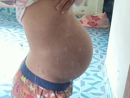 39+2วีค เเล้วคะ