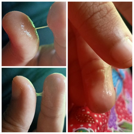 39+2วีคเเล้วคะ