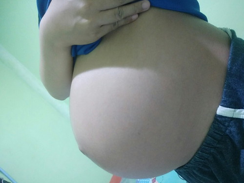 ท้องแหลมโบราณว่าได้ลูกชาย??