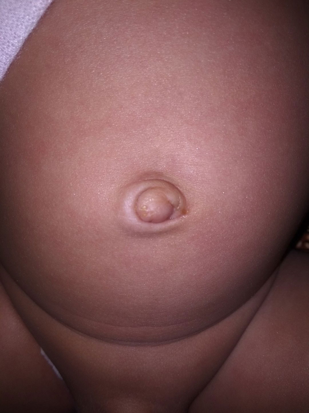 Pusar Basah/keluar Air